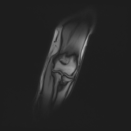 Click on the Serie image to view the images of Wieszt, Gnter